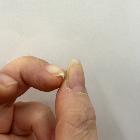 Super Damaged nails