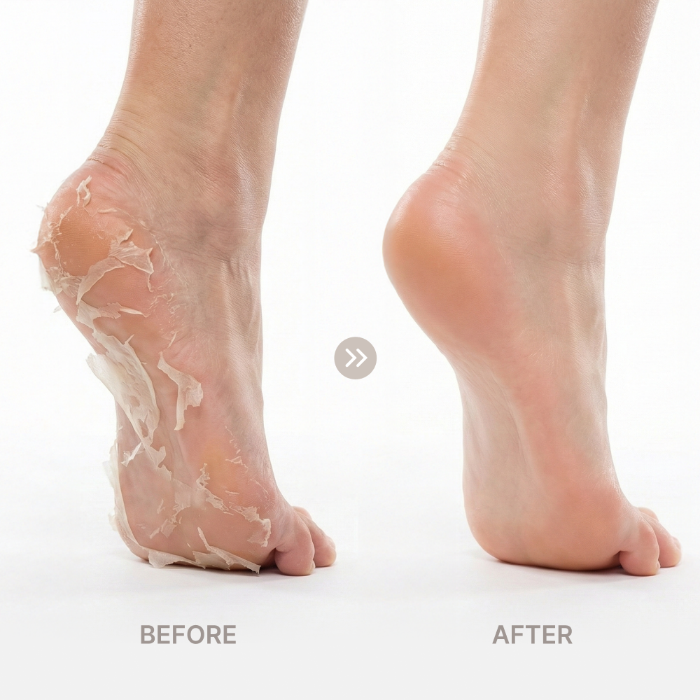 UUUUU MAGICAL Foot Peeling MASK