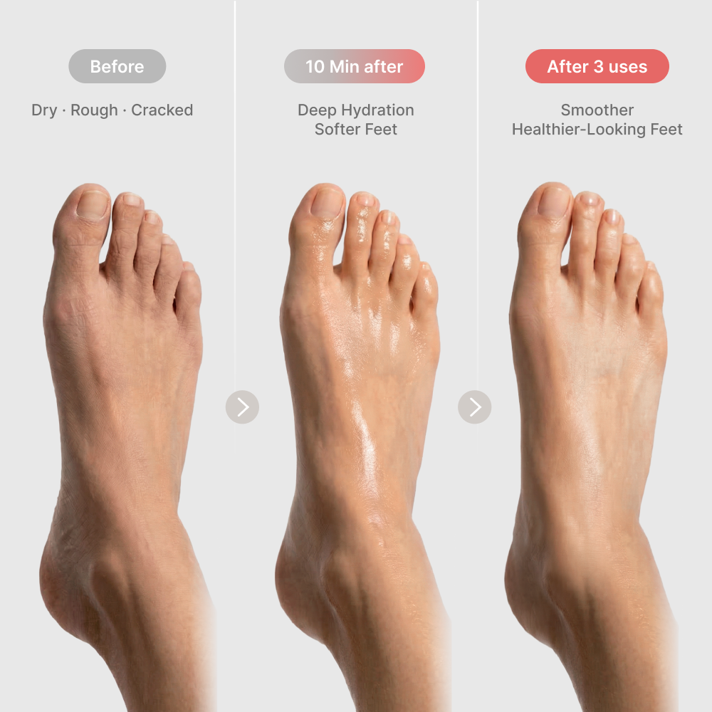 MAGICAL Repairing FOOT MASK